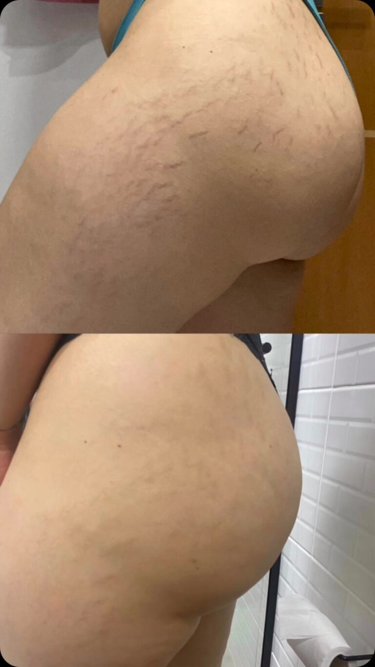 Instagram post from aluriestetica. This post is in position 2.