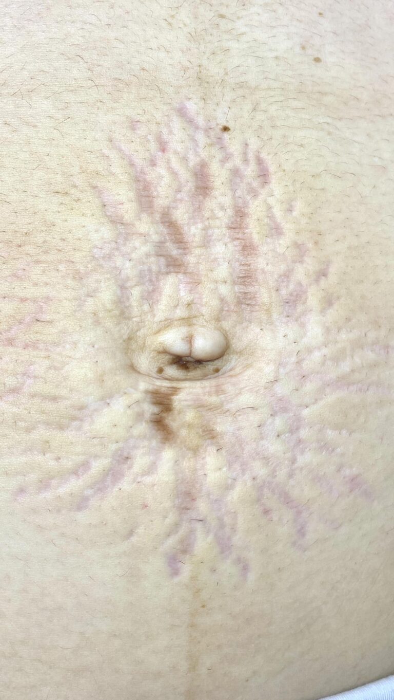 Instagram post from aluriestetica. This post is in position 5.